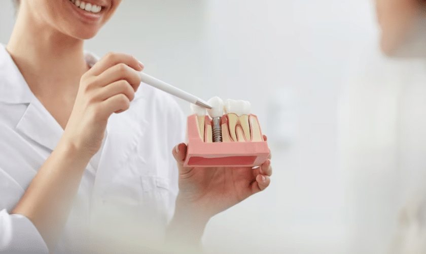 How To Care For Your Dental Implants