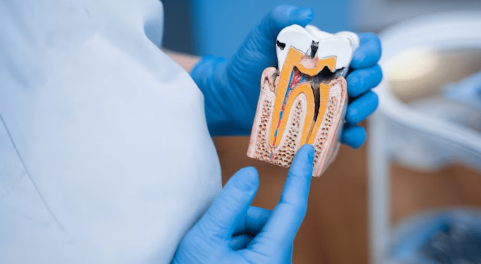 Causes of Tooth Pain After Root Canal Explained