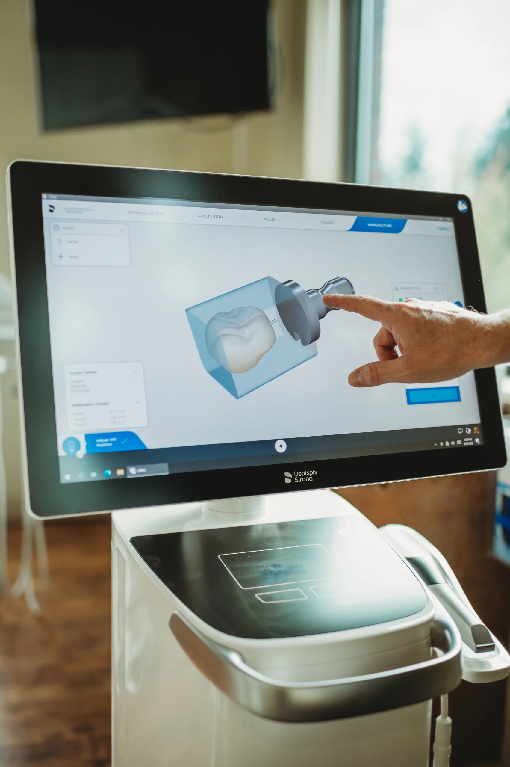 Digital dental scan