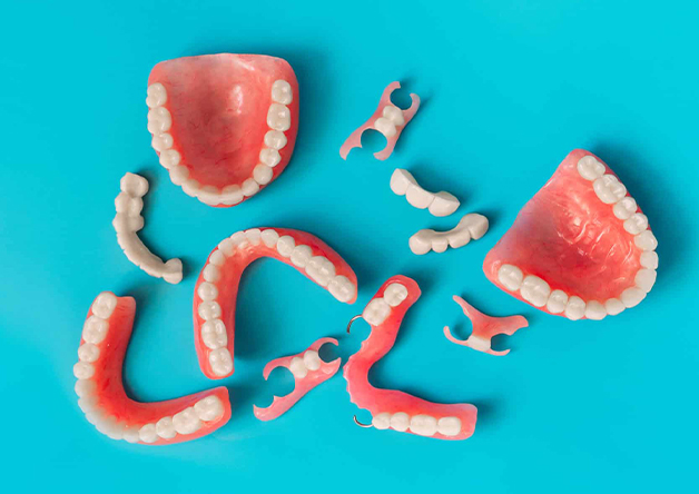 Gresham Advanced Dentistry – Implant Supported Dentures Implant-supported denture components at Gresham Advanced Dentistry in Gresham, OR