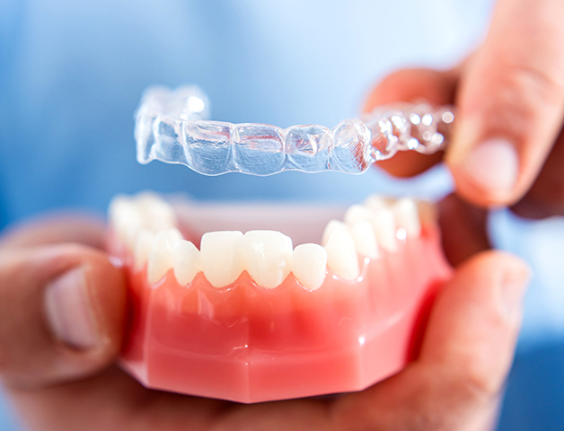 Gresham Advanced Dentistry – Invisalign Aligner Fit Invisalign clear aligner placed on a dental model in Gresham, OR