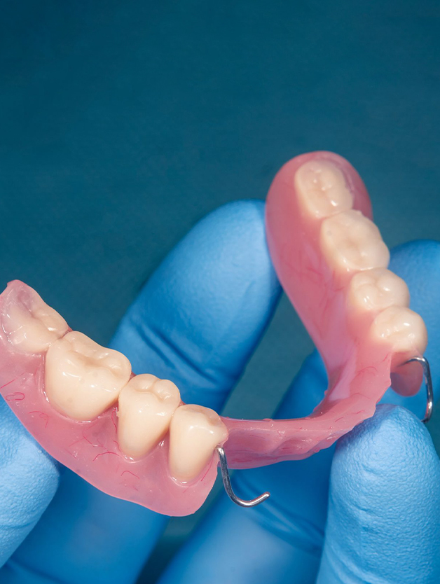Gresham Advanced Dentistry – Partial Denture Custom partial denture crafted for patients of Gresham Advanced Dentistry in Gresham, OR