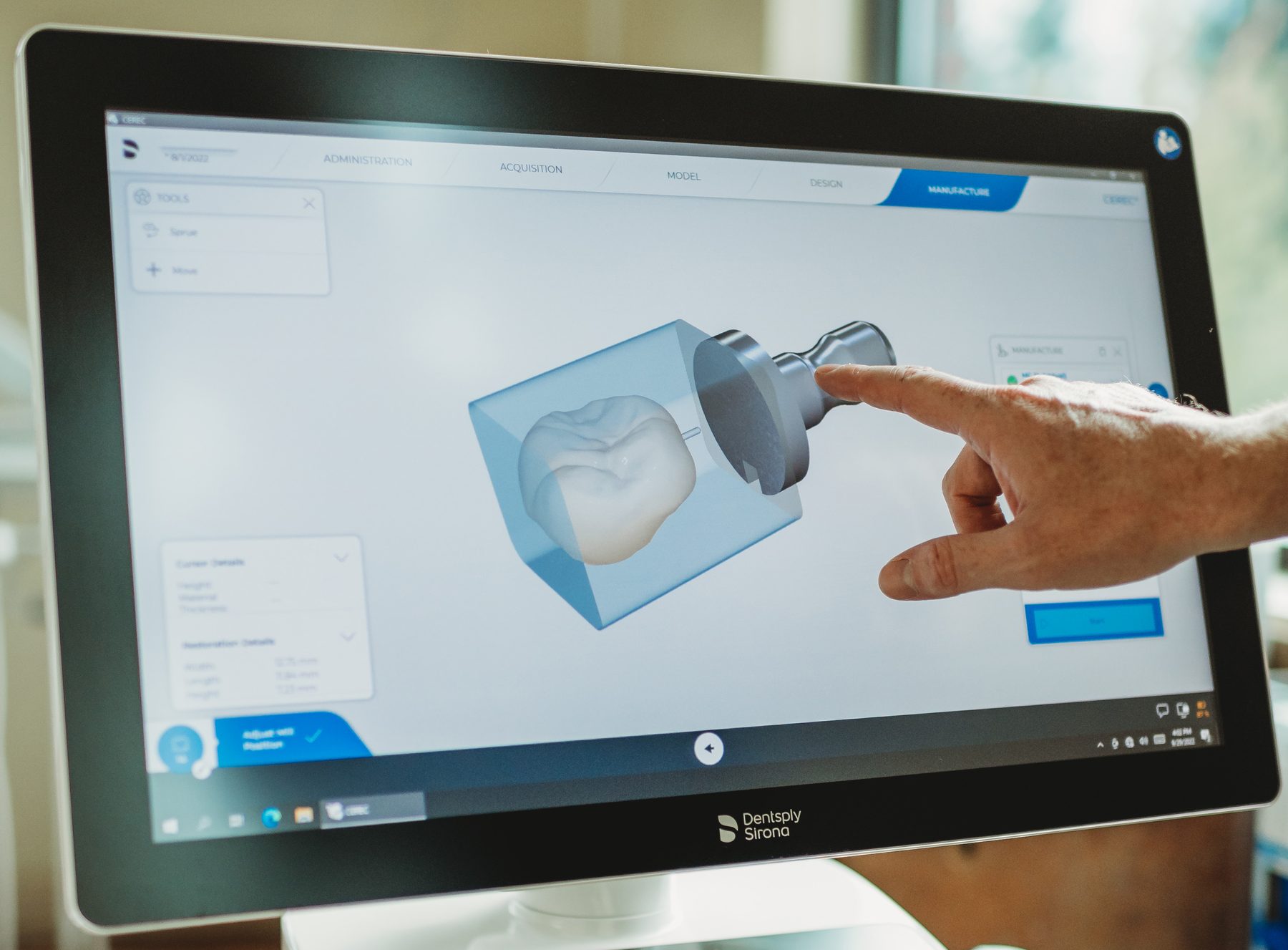 gad-awa-cerec-crown-design-screen Hand using a touchscreen to design a same-day dental crown in 3D